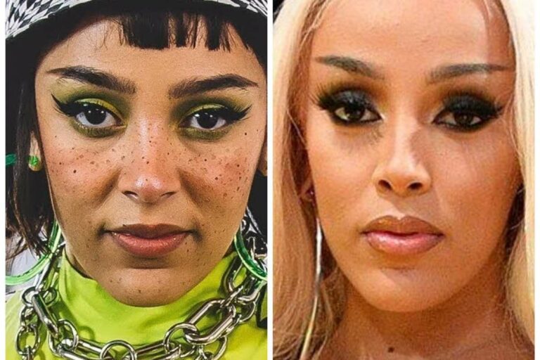 Doja Cat Plastic Surgery: Did She Change Her Face? - Lake County News