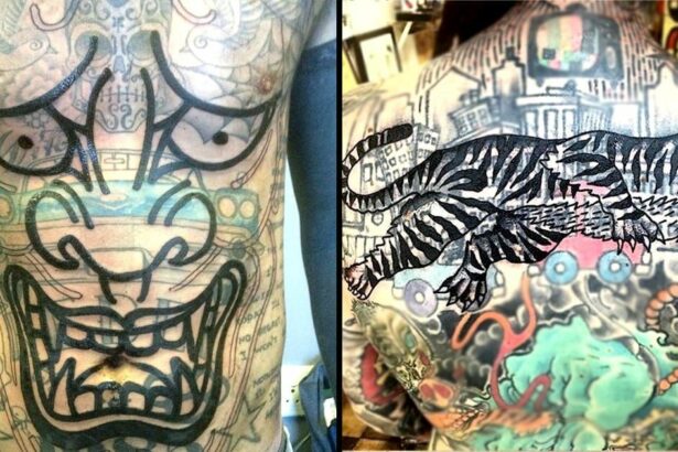 Can You Safely Remove Tattoos with a Blast Technique?