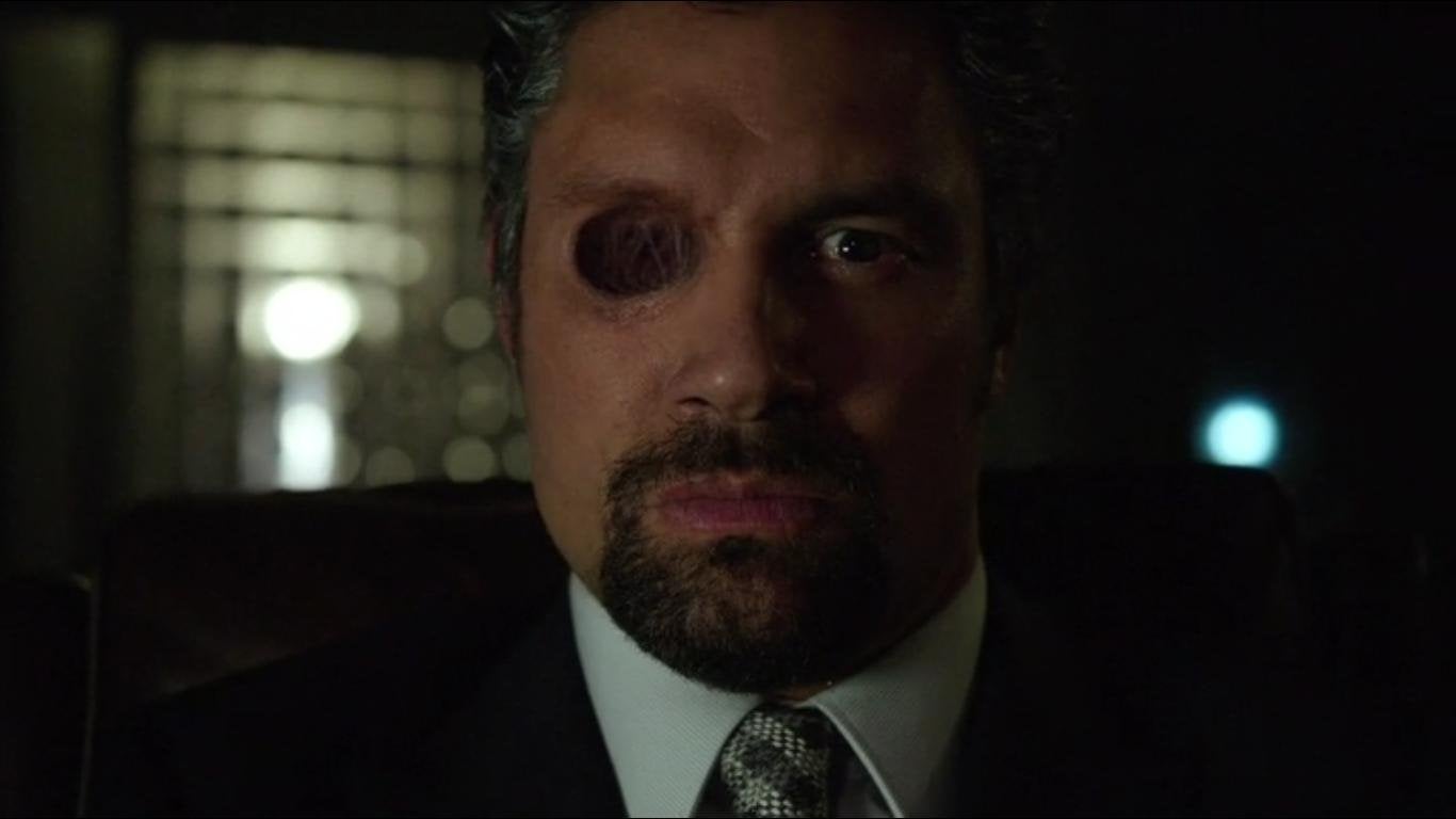 [TRIGGER]Slade Wilson's eye : trypophobia