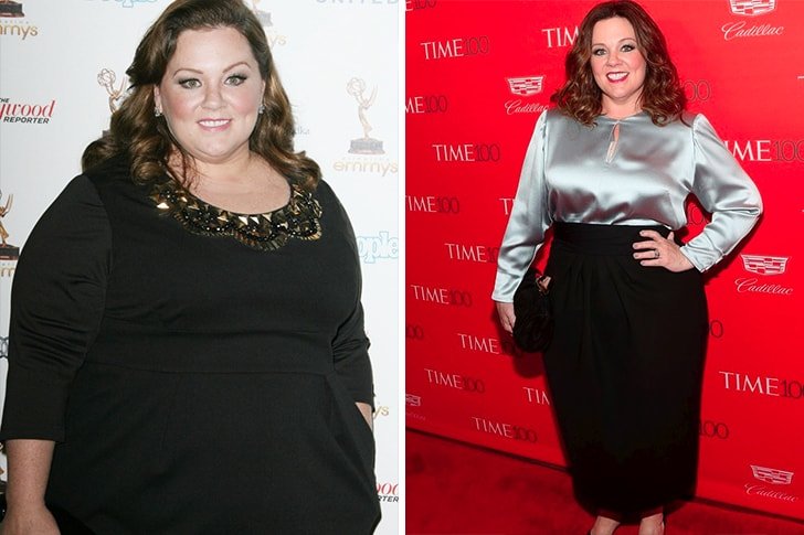 Celebs Who Had Gastric Sleeve Surgery To Stay Fit - How Many Pounds ...