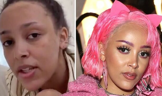 Understanding Doja Cat's Recent Surgical Procedure.