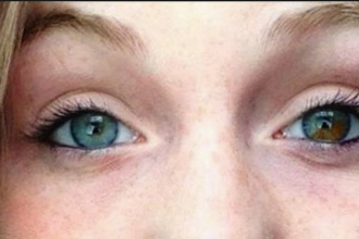 Exploring the World's Most Uncommon Eye Colors.