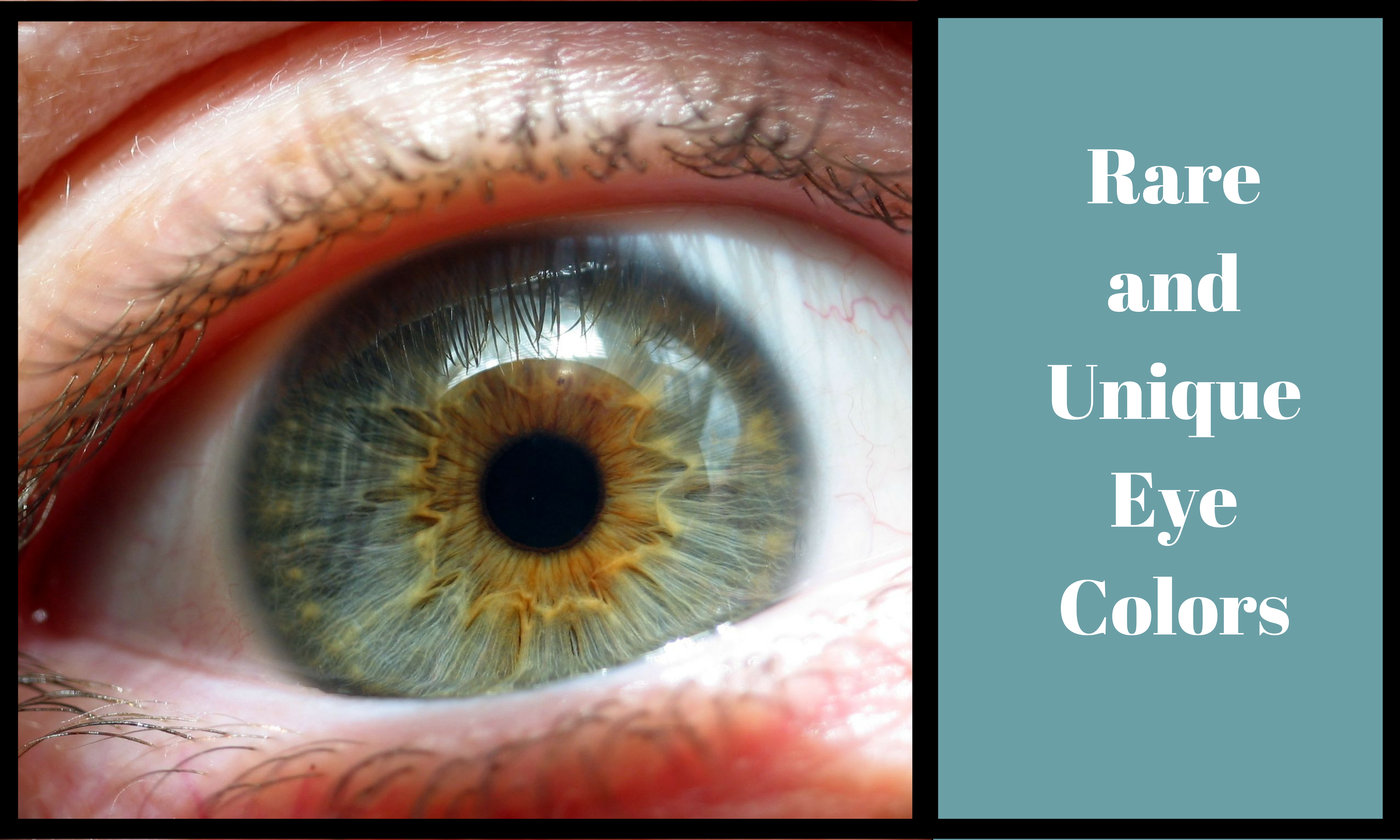 6 Rare and Unique Eye Colors | Rare eyes, Rare eye colors, Eye color chart