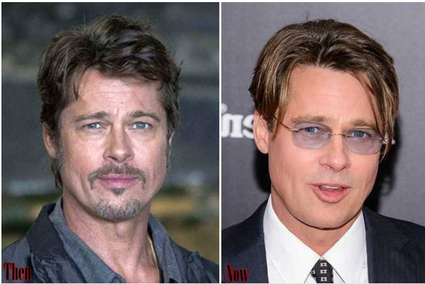 Health, Happiness and Health Promotion | Brad pitt plastic surgery ...