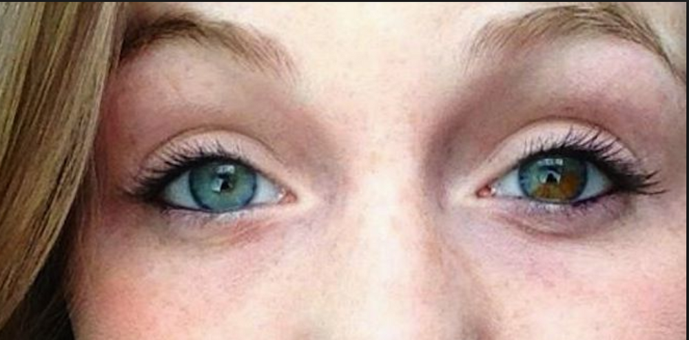 The Six Rarest Eye Colors in the World